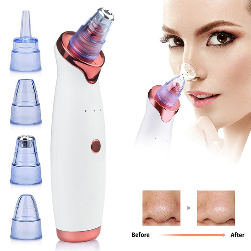 Electric Vacuum Facial Blackhead Remover - Blissful Bundle